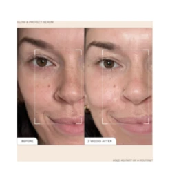 Ren Radiance Perfection Serum 7 Ren Radiance Perfection Serum -Care Product Shop Radiance Perfection Serum add2 33116 4888 general