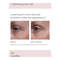 Dr Loretta Tightening Eye Gel 3 Dr Loretta Tightening Eye Gel - Image 3